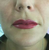 Lippen Vollschattierung (direkt nach der 2. Behandlung) by Alma